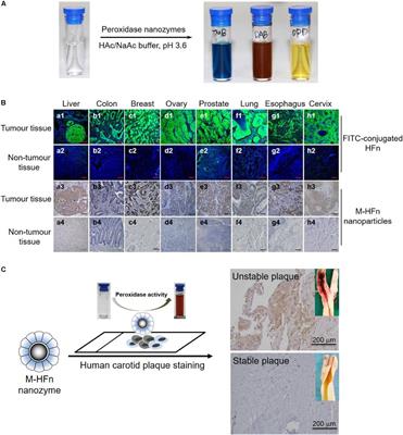 Nanozymes: A New Disease Imaging Strategy